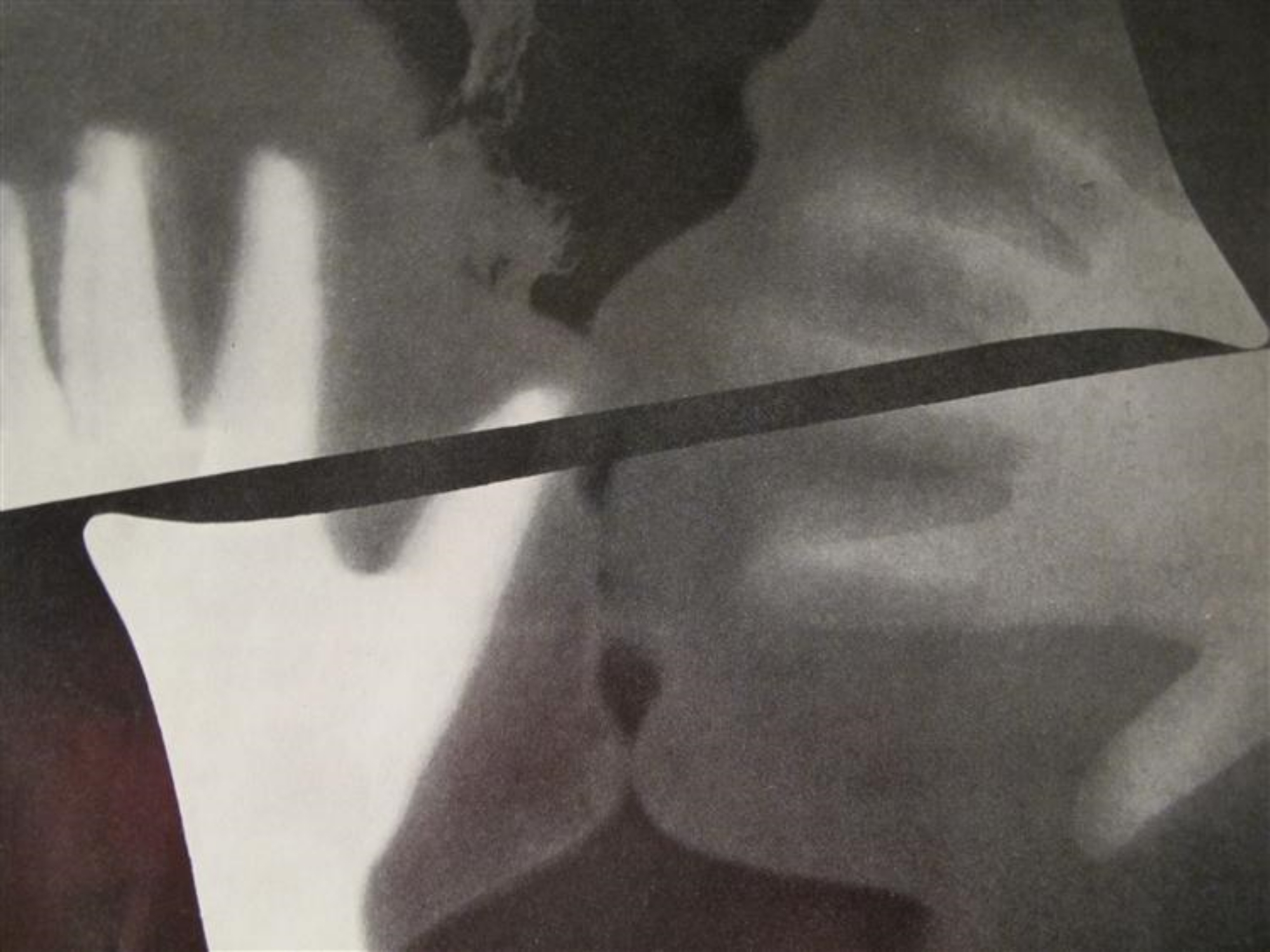 rayograph_the_kiss_man_ray.jpg
