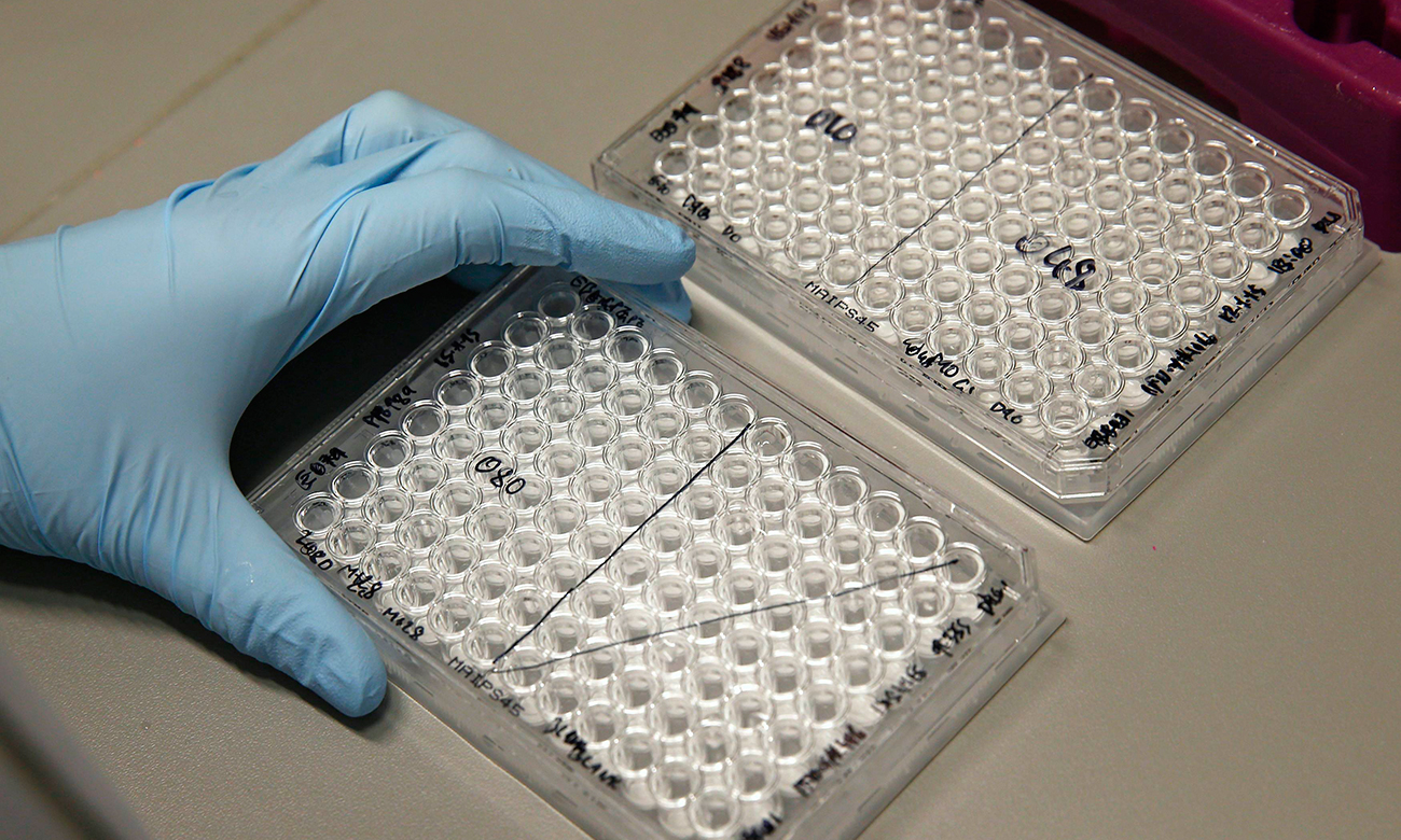Experimental-Ebola-1-NS.jpg