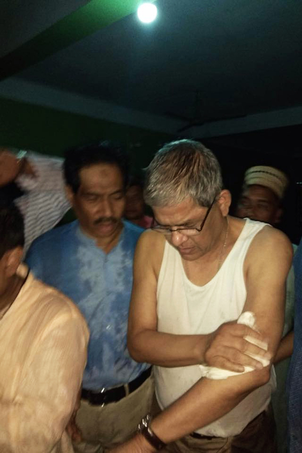 fakhrul-hurt-rangunia-attack-bnp
