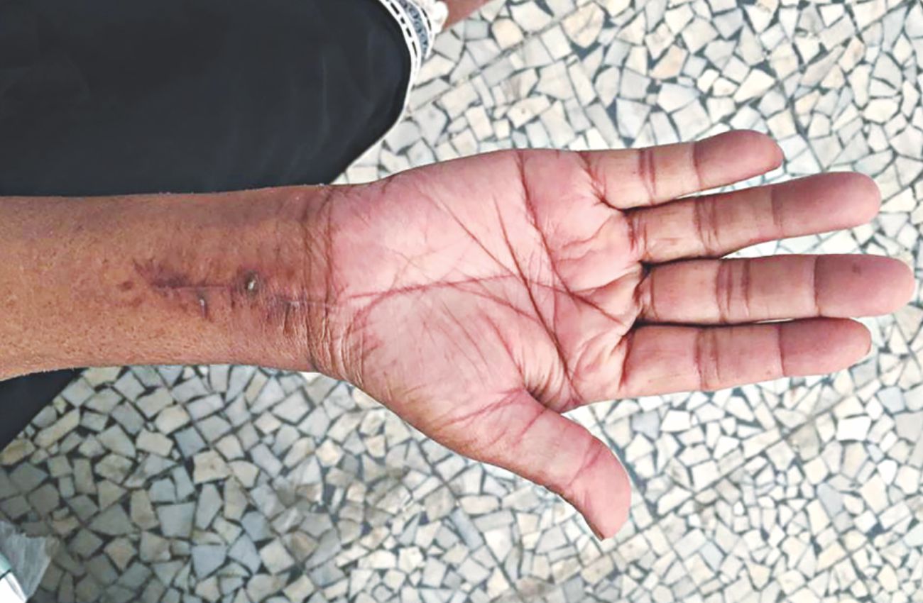 hand