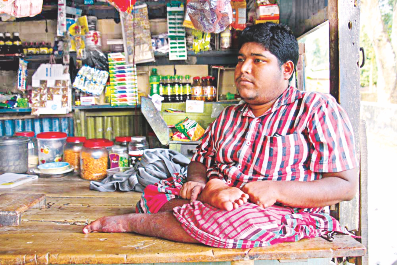 physically challenged 3.jpg
