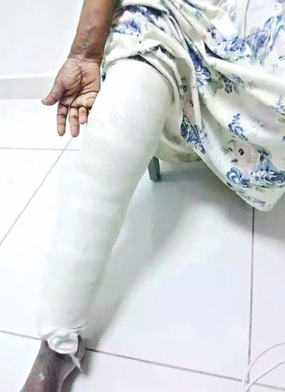 rehanas_leg.jpg