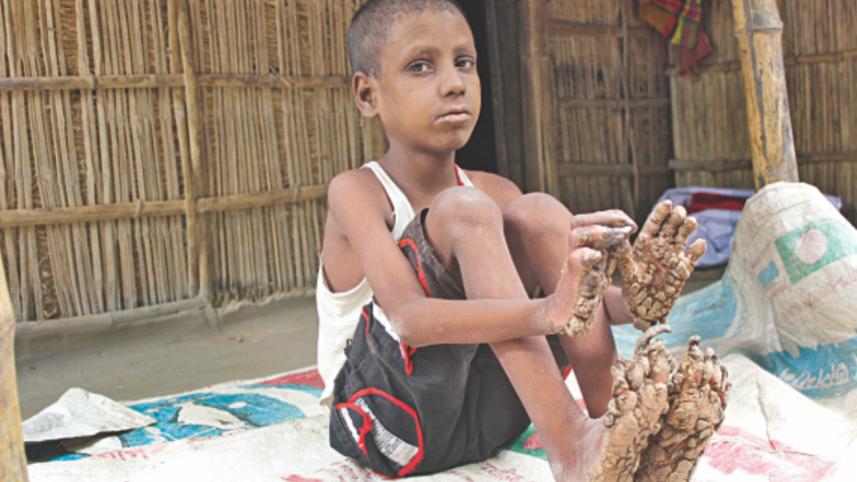 A young boy.jpg