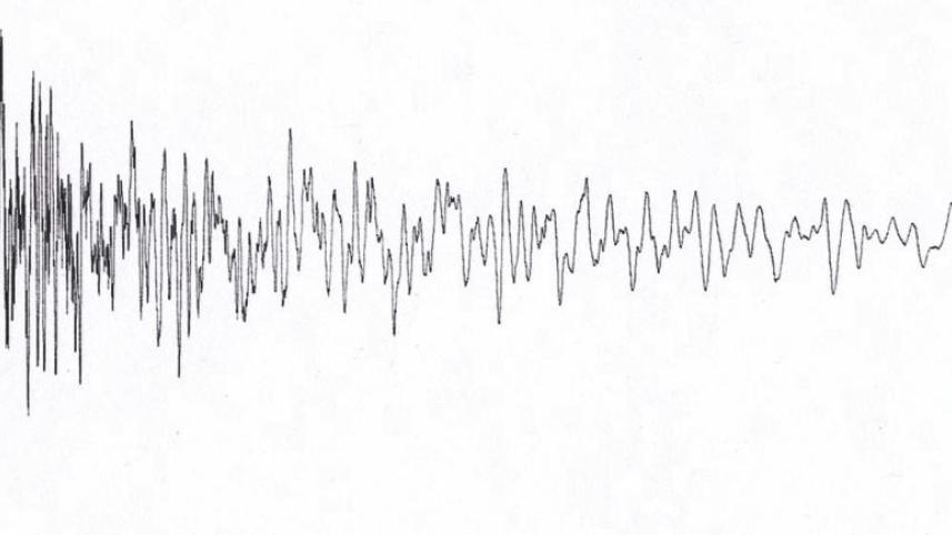 Electro pop sensibilities