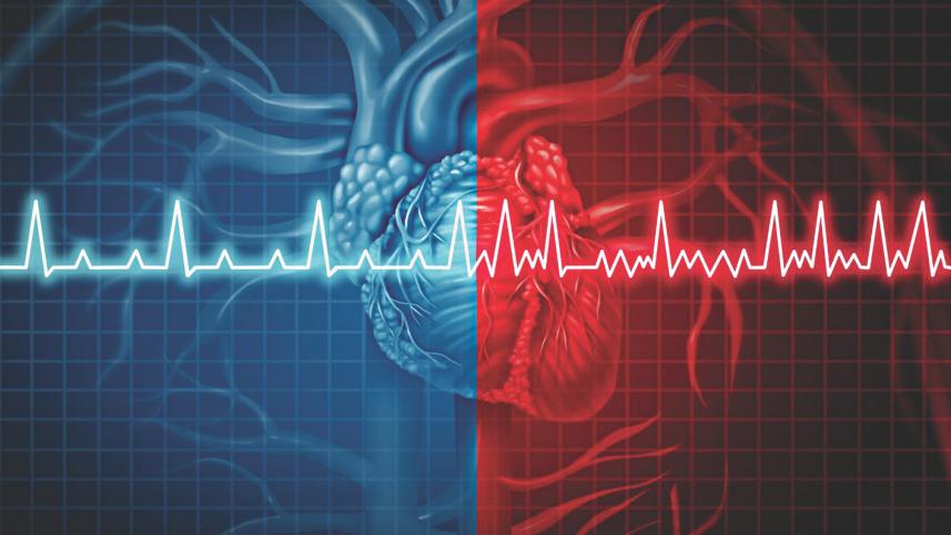 Functional disease of heart