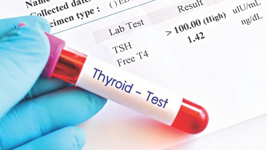 hypothyroidism.jpg