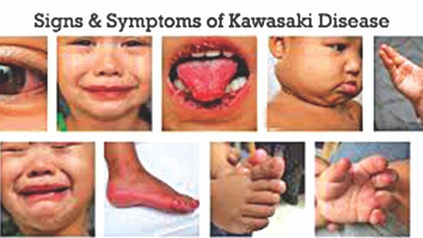 kawasaki.jpg