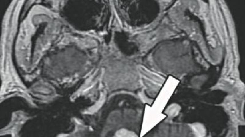mri.jpg