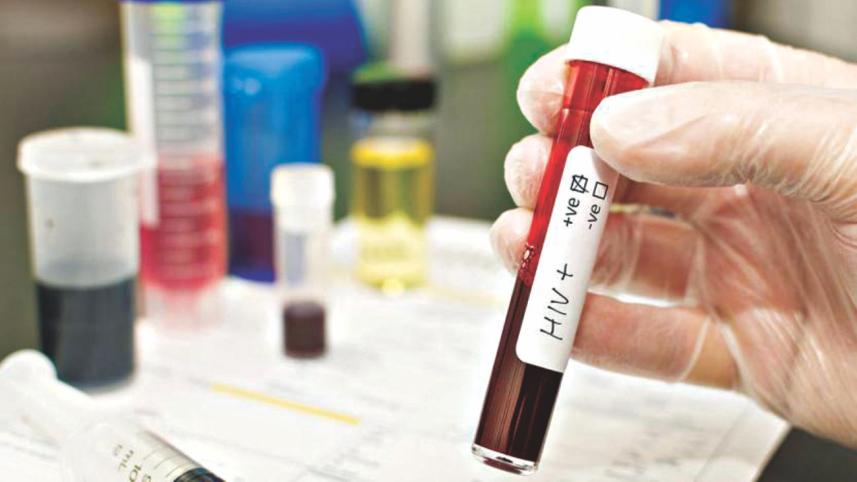 utero HIV.jpg