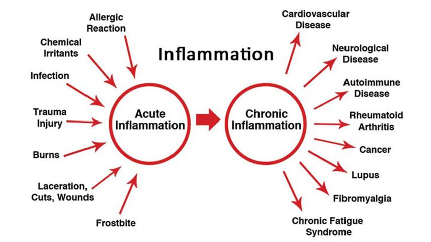 types-of-inflammation_web.jpg