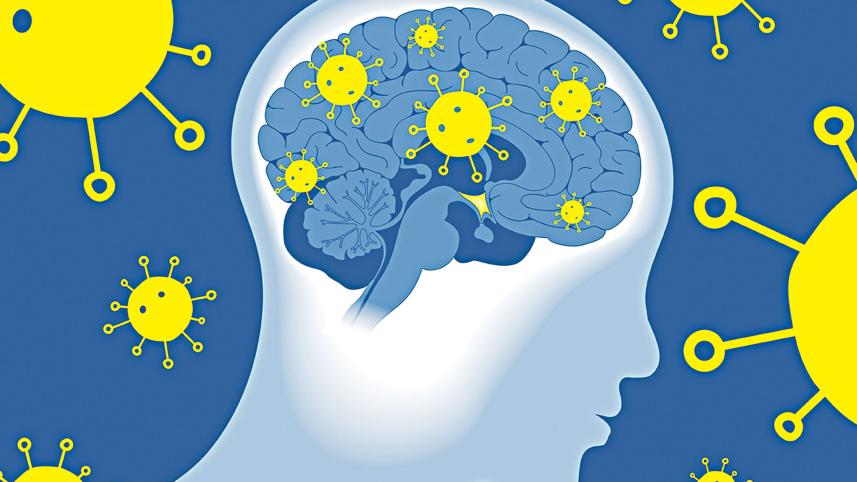 covid-brain.jpg