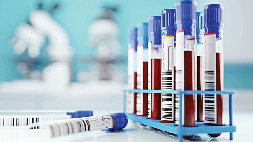 blood-sample.jpg