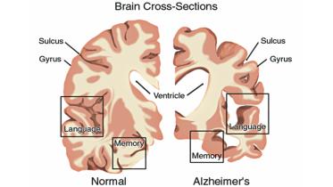 brain.jpg