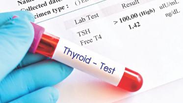 hypothyroidism.jpg