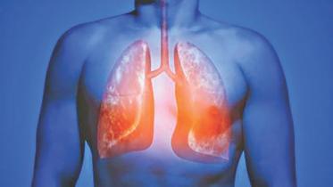 lungs.jpg