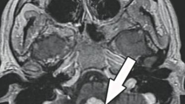 mri.jpg