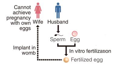 Japan birth resulting from an anonymous third-party egg