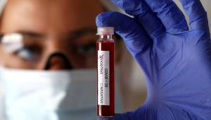 corona-rt-pcr-test.jpg