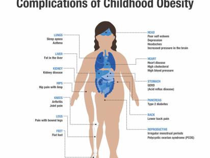 How the kidS got FAT